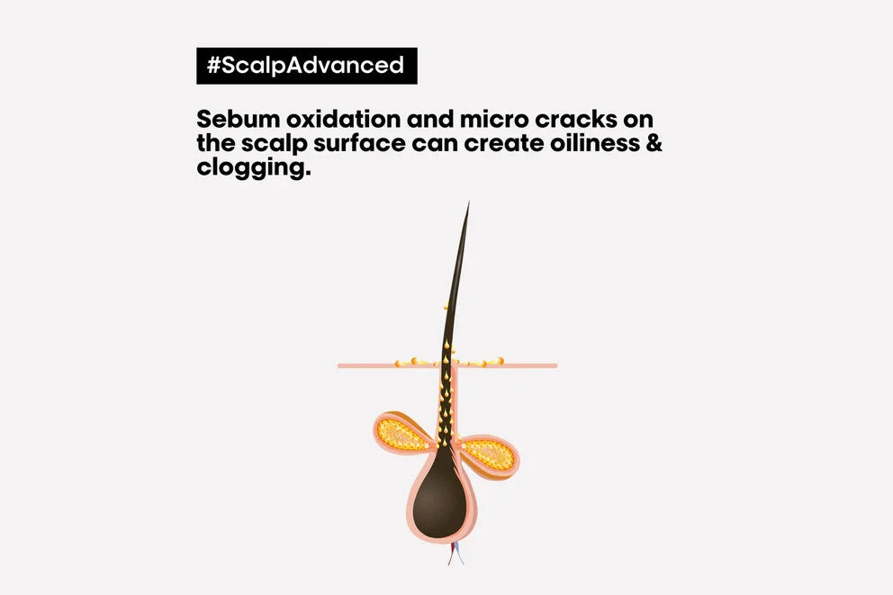 L'Oréal Professionnel Scalp Advanced Anti-Oiliness Shampoo 300mL - Elluca