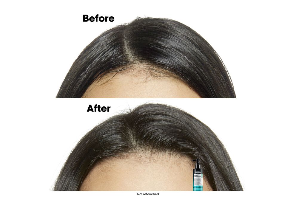 L'Oréal Professionnel Scalp Advanced Anti-Oiliness Serum 90mL - Elluca