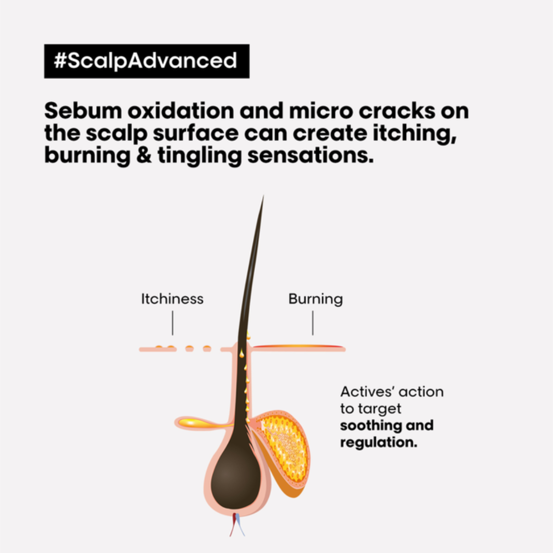 L’Oréal Professionnel Serie Expert Scalp Advanced Anti-Discomfort Conditioner 200mL