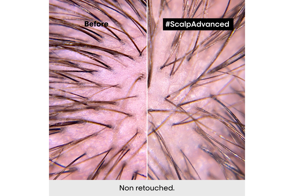 Winter Haircare 101: Tackling Oily Roots & Greasy Scalps (Plus a Free Gift!)