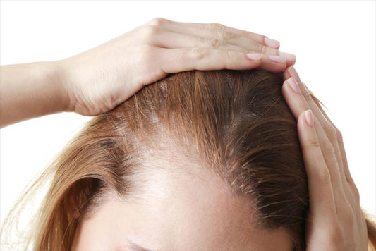 How Peri-Menopause and Menopause Affect Your Hair: What You Need to Know